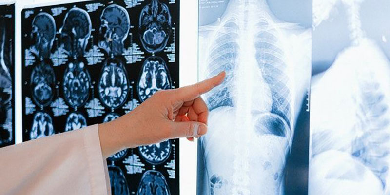 کاربرد هوش مصنوعی در تشخیص بیماری